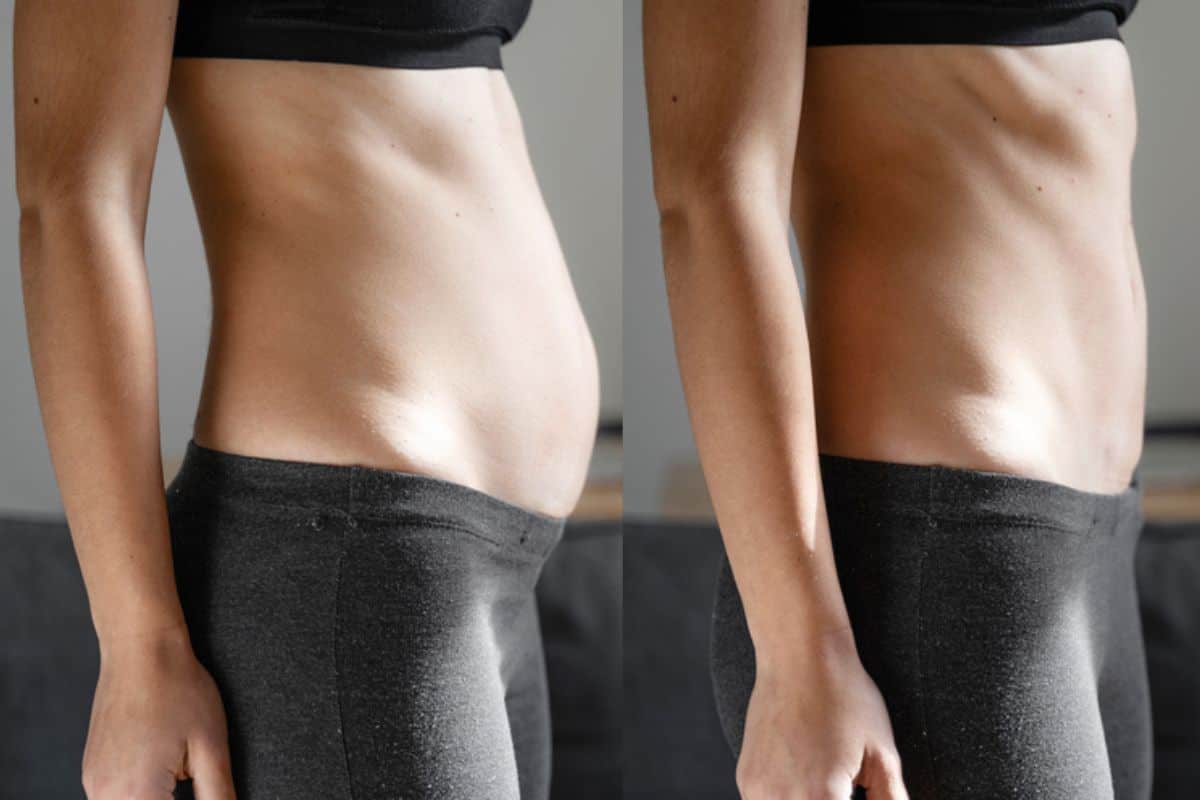 Post-Pregnancy: What Happens to Your Abdominal Muscles After Birth Greater London (Brent)