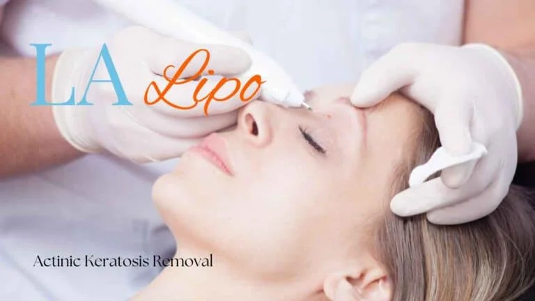 Woman receiving Actinic Keratosis Removal Treatment Greater London (Brent)