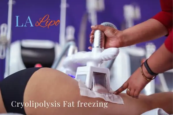 women getting fat freezing Greater London (Brent)