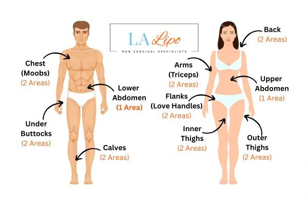 LA LIPO Cryolipolysis Areas Greater London (Brent)
