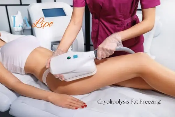 Woman receiving coolsculpting Greater London (Brent) treatment on her thighs