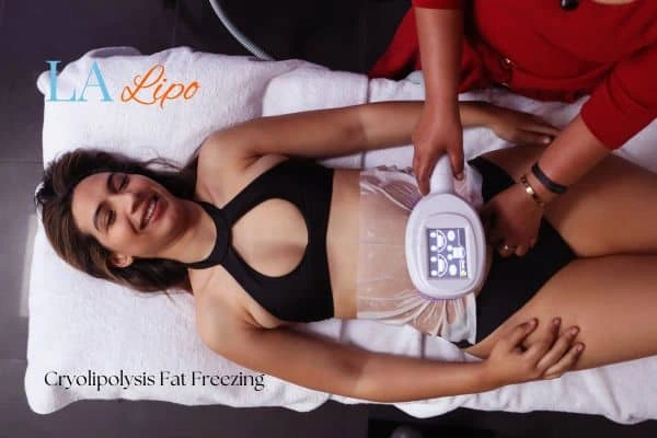 woman getting cryolipolysis Greater London (Brent)