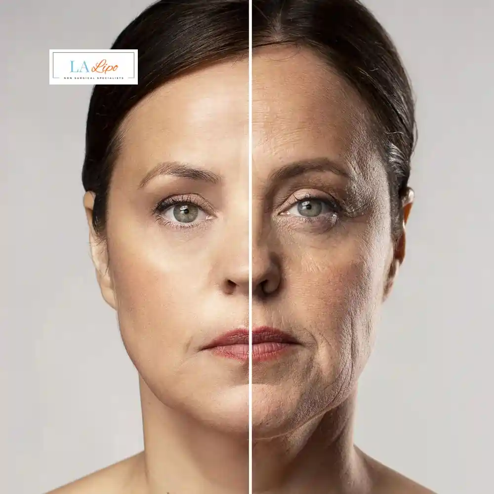 How Can You Tell If Non-Surgical Skin Tightening Is Right for You Greater London (Brent)?