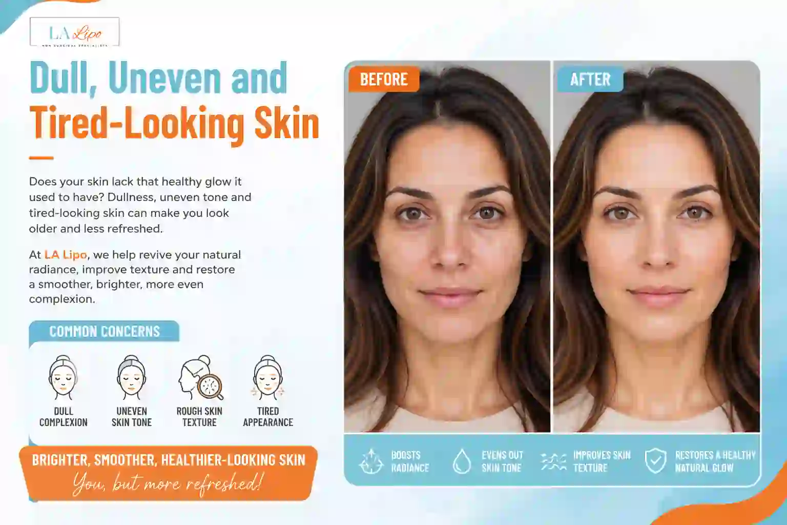 Sign #5: Dull, Uneven and Tired-Looking Skin Greater London (Brent)