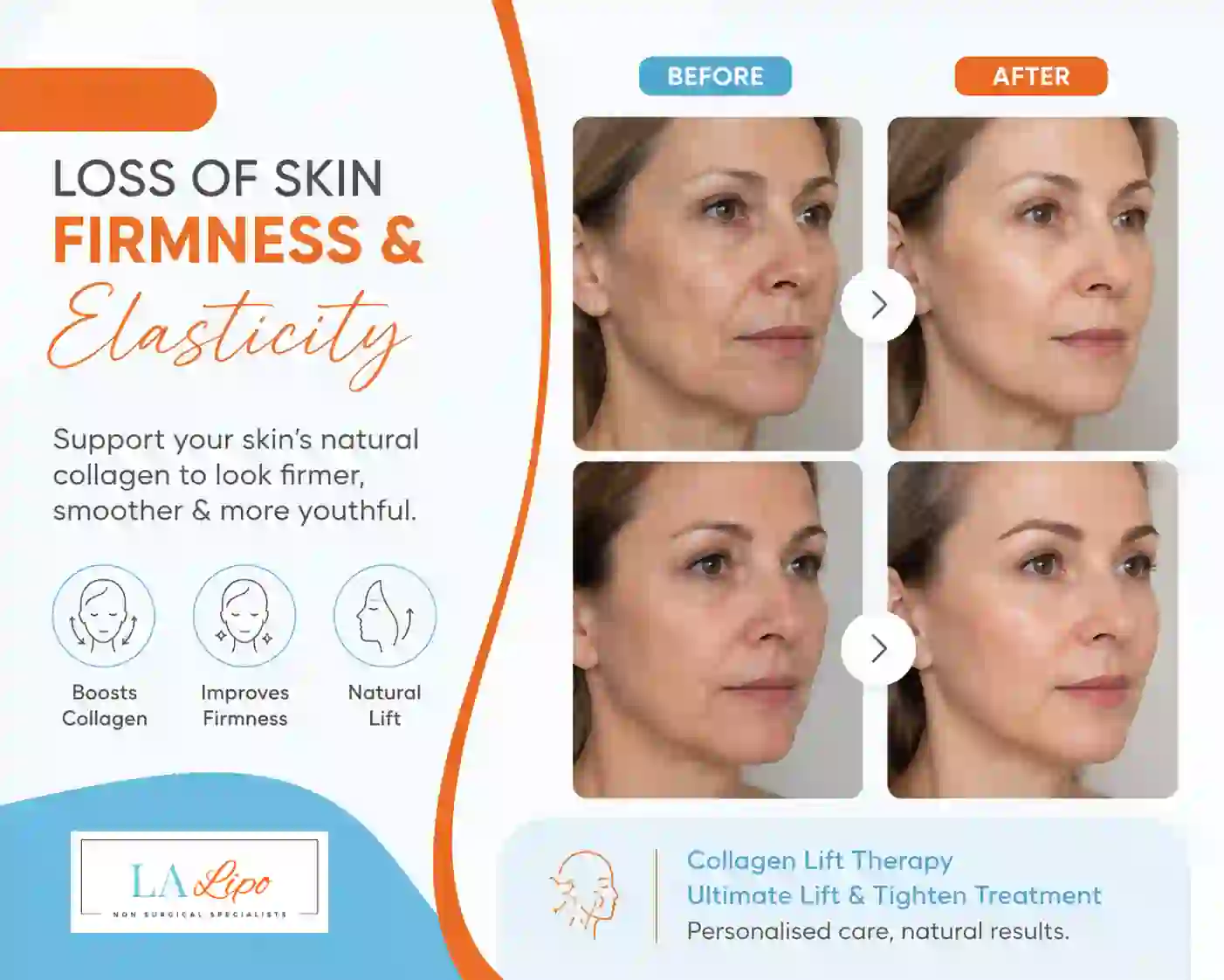 Sign #7: Loss of Skin Firmness and Elasticity Greater London (Brent)